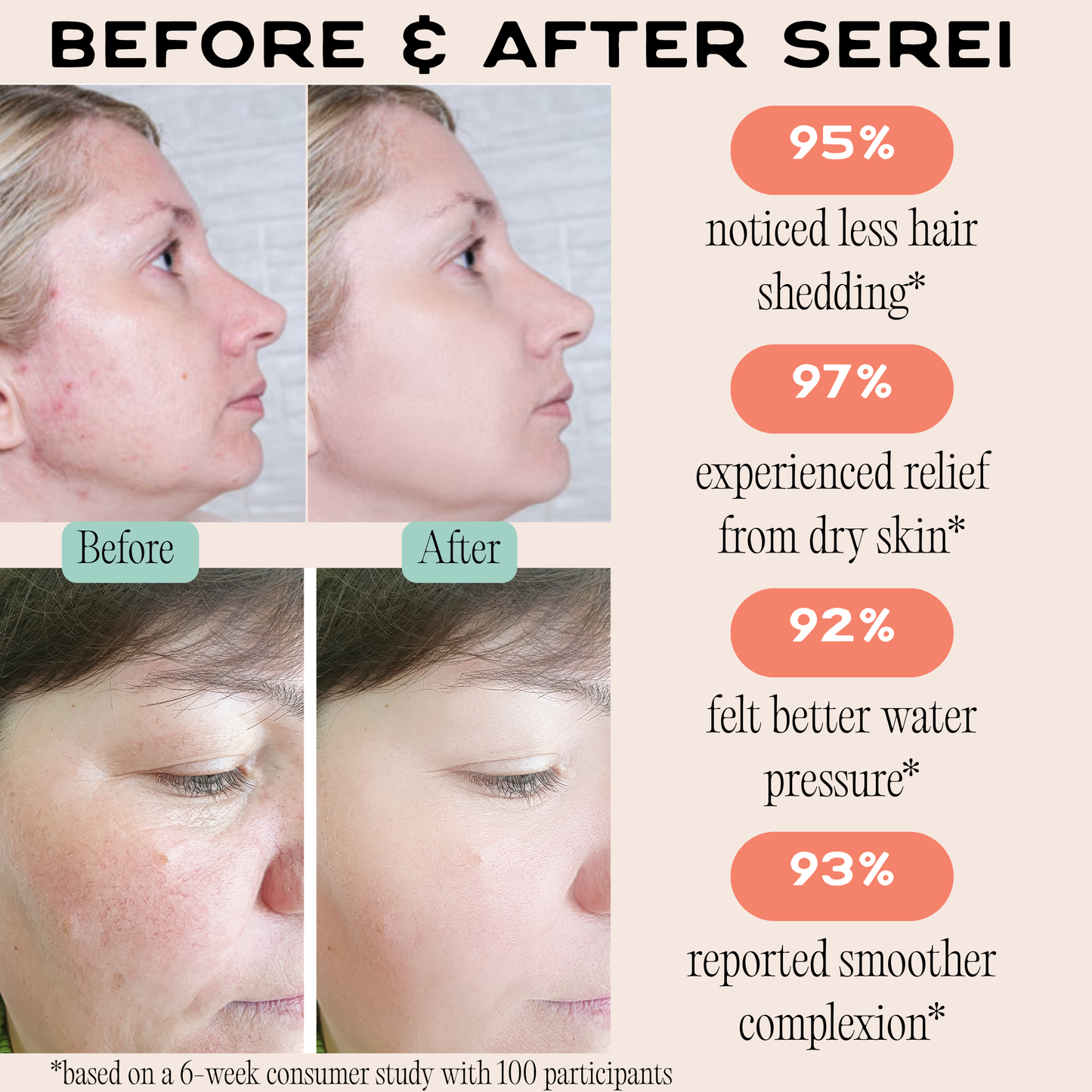 Serei Filtered Showerhead